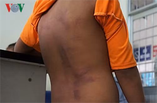 4 hoc sinh bi danh bam tim o Ca Mau duoc ban giao cho cha me