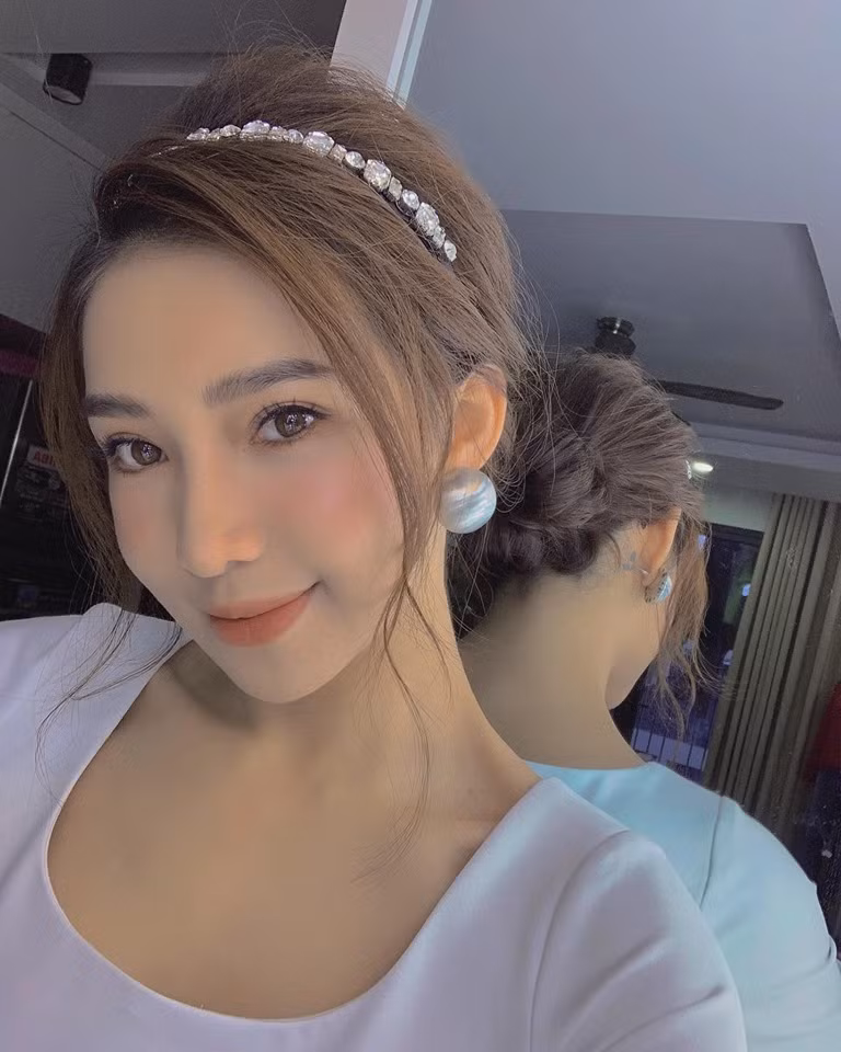 Sau khi phẫu thuật, khuôn mặt của Lưu Đê Ly thanh thoát hơn rất nhiều.