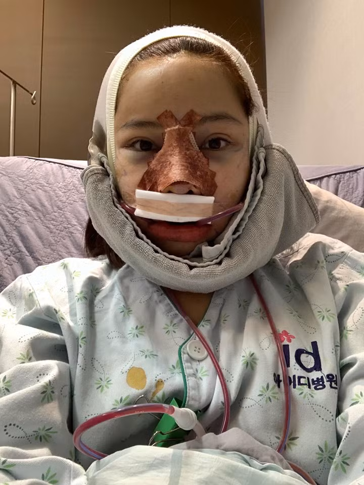 Nữ diễn viên Lưu Đê Ly còn bất ngờ công khai toàn bộ quá trình "nâng cấp nhan sắc" của mình ở Hàn Quốc.