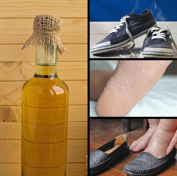 Trị mùi hôi, chân bong da hay nứt nẻ: Giấm táo giúp khử mùi, tẩy tế bào chết và làm mềm da chân. Trộn một phần giấm với hai phần nước nóng, ngâm chân trong khoảng 15 phút rồi lau sạch và thoa kem dưỡng.