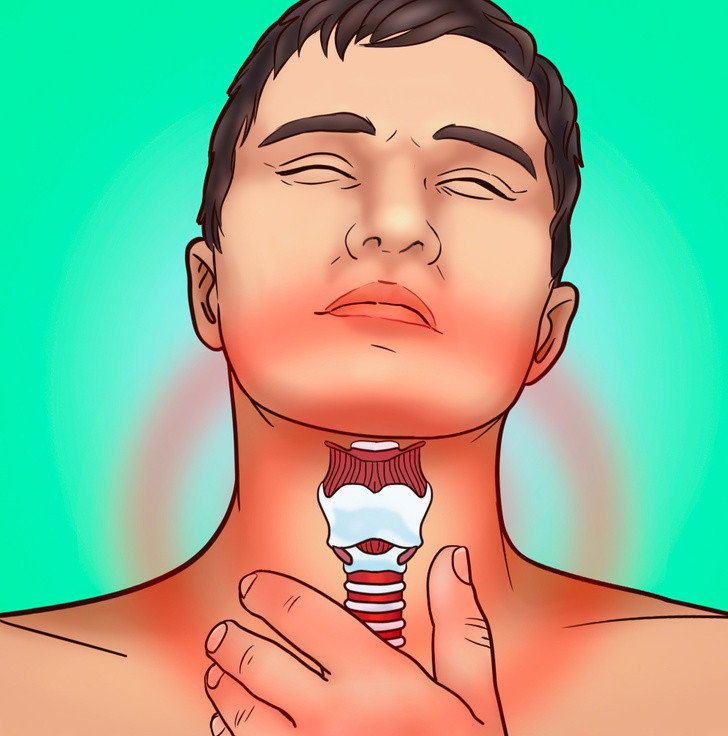 Cổ bị sưng: Một vùng sưng trên cổ thường được gọi là bướu cổ và xảy ra khi tuyến giáp của chúng ta trở nên lớn bất thường. Khi cơ thể chúng ta không có đủ iốt, tuyến giáp không thể sản sinh hormone khiến cho cổ của chúng ta bị sưng lên.