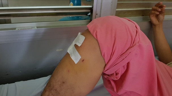 Benh nhan gay xuong nguc bi khoan chan: Ap luc khien bac si nham?