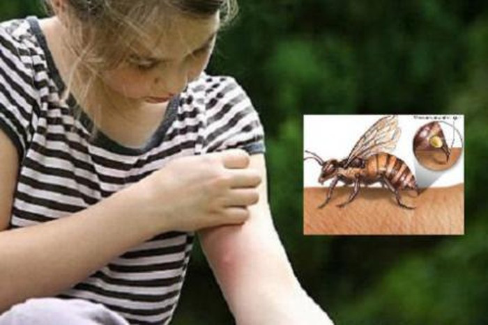 Khi da bị đâm vào dằm hay bị côn trùng cắn, thoa một lượng nhỏ cao này vào vết thương và dùng băng y tế dán lại. Sau khoảng nửa ngày, bạn rửa sạch vết thương bằng xà phòng và nước. Dằm sẽ bị rửa trôi và vết thương sẽ chóng lành hơn. Ảnh: nhatkibe.vn.