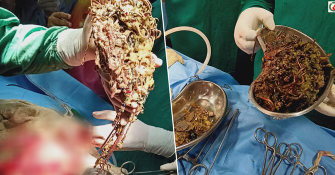 Dau bung, non lien tuc, co gai gay “soc” vi bung chua di vat 1,5 ty-Hinh-2