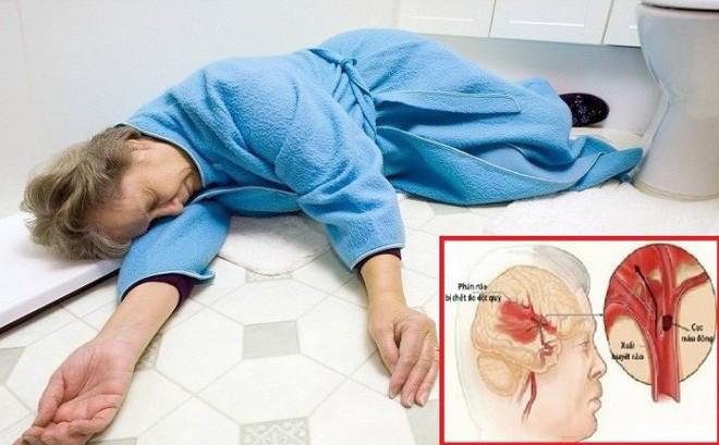 Tu truong hop nghe si Anh Vu, bac si chi cach phong nguy co dot tu-Hinh-3