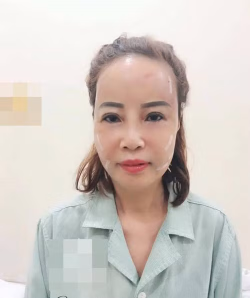 Co dau 62 tuoi chiu nhieu dau don sau khi chi bon tien “dao keo”-Hinh-2