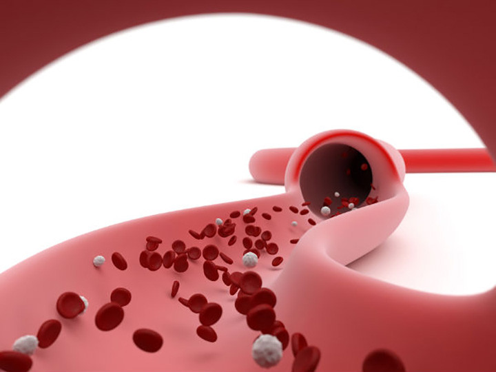 Chảy máu quá mức: Vitamin K rất quan trọng để ngăn ngừa chảy máu trong và ngoài. Mô đun protein này kích hoạt bởi vitamin K giúp máu đông. Do đó, sự thiếu hụt vitamin K có thể dẫn đến chảy máu quá nhiều ngay cả khi bị thương nhẹ. Mất máu rất nhiều có thể ảnh hưởng xấu đến sức khoẻ của bạn.