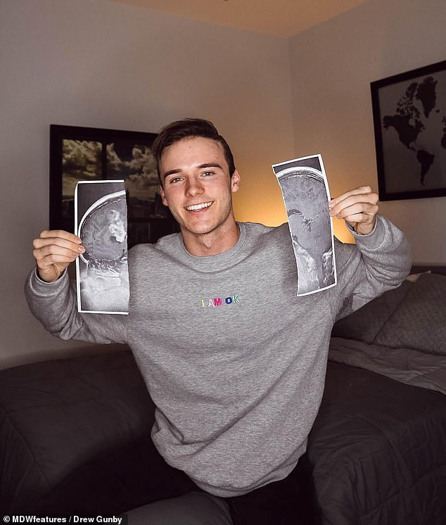 Kỳ lạ chàng trai được cứu sống nhờ vụ tai nạn giao thông - Hình 3 Ky la chang trai duoc cuu song nho vu tai nan giao thong-Hinh-3