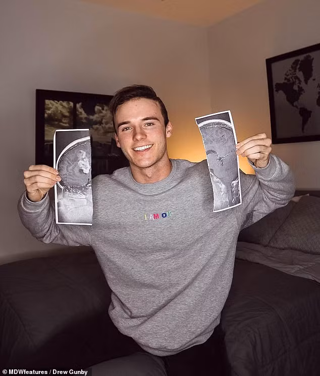 Ky la chang trai duoc cuu song nho vu tai nan giao thong-Hinh-3