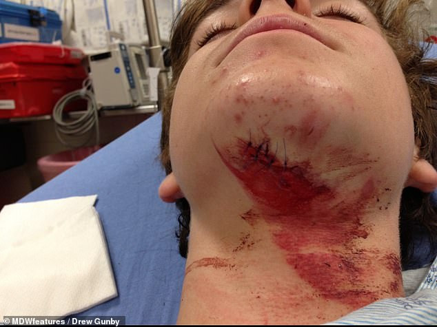 Kỳ lạ chàng trai được cứu sống nhờ vụ tai nạn giao thông Ky la chang trai duoc cuu song nho vu tai nan giao thong