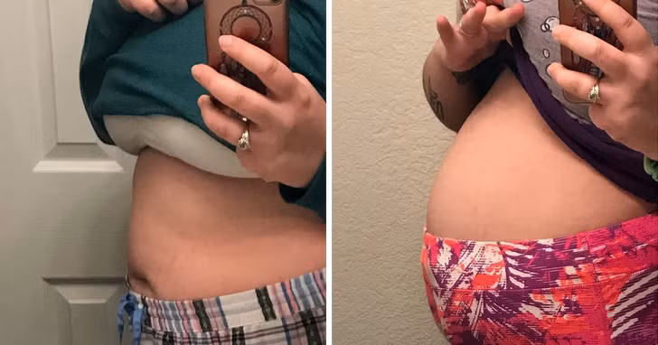 Đầy bụng: Nếu tình trạng này kéo dài hơn 2 tuần không rõ nguyên nhân, đó là dấu hiệu cho thấy cơ thể mất cân bằng. Trong trường hợp bệnh lạc nội mạc tử cung, bụng bạn có thể bị đầy vào bất cứ ngày nào, và kéo dài từ vài tiếng đến vài tuần. Đầy bụng cũng có thể là dấu hiệu của ung thư vú hoặc ung thư cổ tử cung.