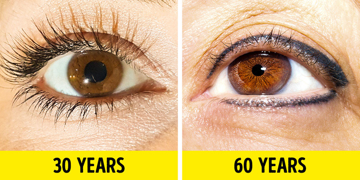 Lông mi rụng và ngắn lại: Chăm sóc mí mắt không đúng cách, các vấn đề về tuyến giáp và dị ứng là những yếu tố phổ biến nhất ảnh hưởng đến độ dài và độ dày của lông mi. Chúng cũng chắc chắn thay đổi khi bạn già đi. Theo nhiều nghiên cứu, 44% đàn ông và phụ nữ nhận thấy rằng lông mi của họ đã trở nên ngắn và mỏng hơn qua từng năm.