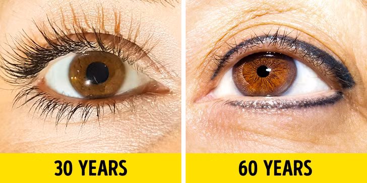 Lông mi rụng và ngắn lại: Chăm sóc mí mắt không đúng cách, các vấn đề về tuyến giáp và dị ứng là những yếu tố phổ biến nhất ảnh hưởng đến độ dài và độ dày của lông mi. Chúng cũng chắc chắn thay đổi khi bạn già đi. Theo nhiều nghiên cứu, 44% đàn ông và phụ nữ nhận thấy rằng lông mi của họ đã trở nên ngắn và mỏng hơn qua từng năm.