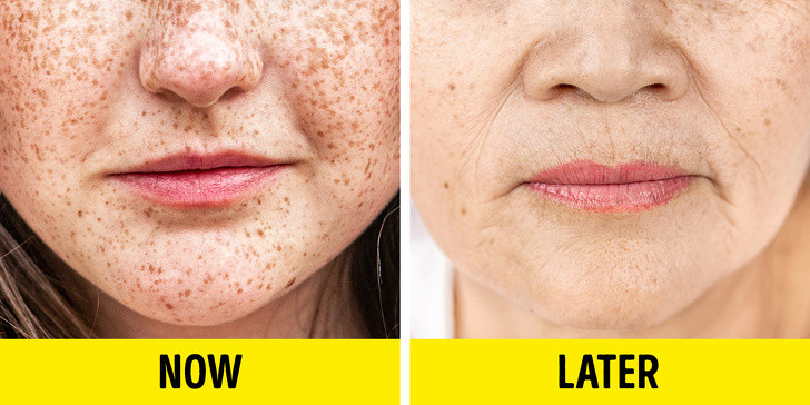 Tàn nhang biến mất: Những người có da sáng và tóc đỏ thường có nhiều đốm tàn nhang trên da khi còn trẻ. Tuy nhiên, chúng sẽ biến mất dần theo thời gian.