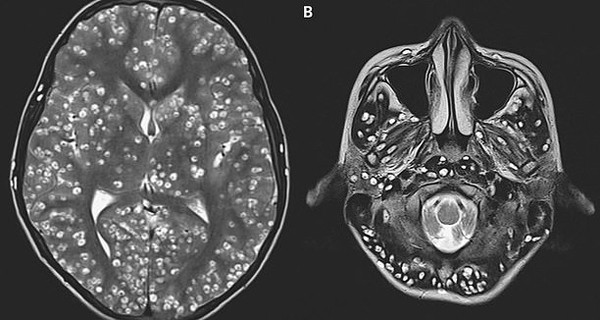Ron nguoi nhung ca san luc nhuc trong co the vi thich an do tai song-Hinh-2