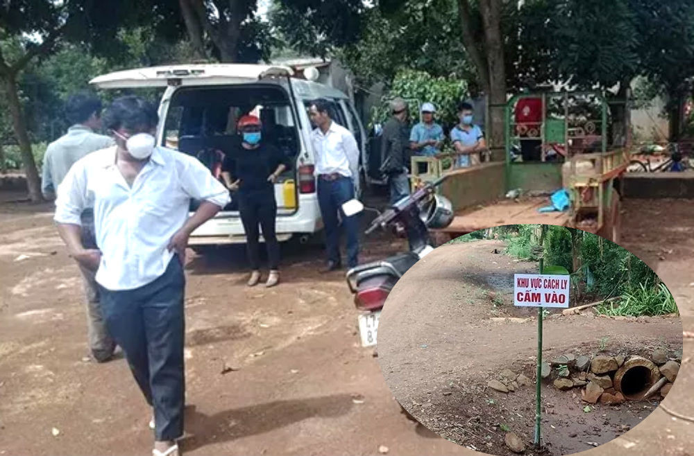 Dau hieu benh bach hau sau vu be gai Dak Lak tu vong?