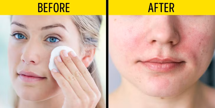 Không rửa mặt sau khi dùng micellar water: Micellar water (nước tẩy trang có chứa tinh thể dầu) là một sản phẩm tẩy trang quen thuộc. Nó giúp thu thập bụi bẩn trên da và chỉ được làm sạch hoàn toàn sau khi rửa mặt với nước. Nếu bạn bỏ qua bước này, làn da sẽ như được bao phủ bởi một lớp xà phòng, tích tụ bụi bẩn ngày một nhiều gây bít tắc lỗ chân lông, khiến da bị viêm, nổi mụn.