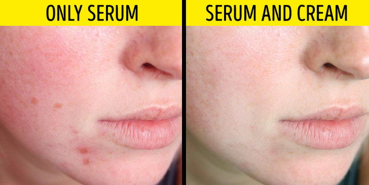 Chỉ dùng serum: Serum thường được thoa trước bước thoa kem dưỡng da. Serum là tinh chất dưỡng, chứa các thành phần giúp làm trắng, trị nám, mờ sẹo, trẻ hoá da. Sản phẩm này cần có sự hỗ trợ của kem dưỡng để phát huy hiệu quả tốt nhất.