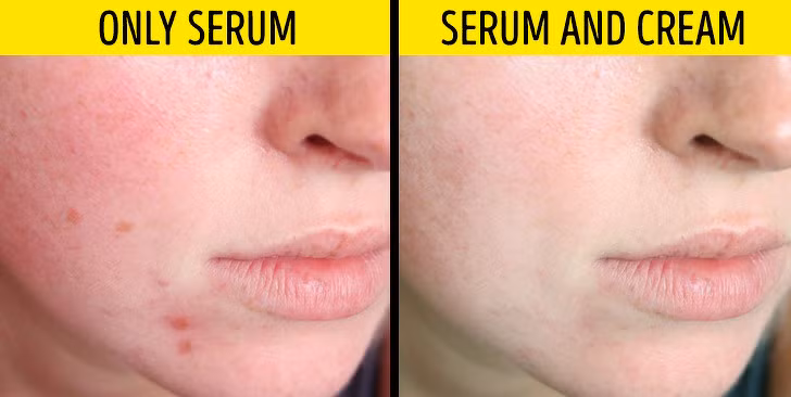 Chỉ dùng serum: Serum thường được thoa trước bước thoa kem dưỡng da. Serum là tinh chất dưỡng, chứa các thành phần giúp làm trắng, trị nám, mờ sẹo, trẻ hoá da. Sản phẩm này cần có sự hỗ trợ của kem dưỡng để phát huy hiệu quả tốt nhất.