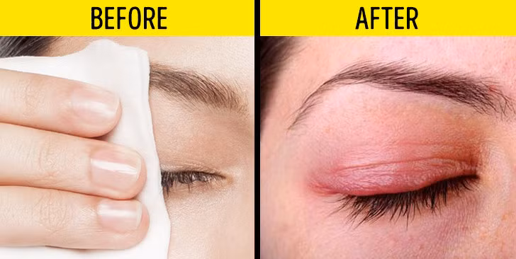 Chỉ dùng khăn giấy tẩy trang: Khăn giấy tẩy trang được quảng cáo là có thể làm sạch mọi lớp trang điểm, bụi bẩn, rất tiện lợi khi sử dụng. Tuy nhiên, đây không phải là sản phẩm làm đẹp nên dùng hàng ngày. Khăn giấy tẩy trang chỉ nên dùng trong trường hợp bất khả kháng, khi bạn không có nước tẩy trang chuyên dụng và sữa rửa mặt.