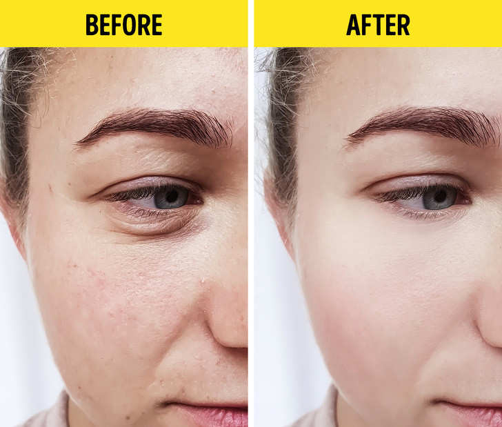 Da đẹp hơn: Một lợi ích của việc giảm cân đó là mang lại một làm da tươi trẻ và khỏe mạnh hơn. Những người thay đổi theo lối sống lành mạnh và giảm cân sẽ cảm thấy ngoại hình thay đổi rõ rệt: da đẹp hơn, tóc dày hơn và móng tay cứng hơn.