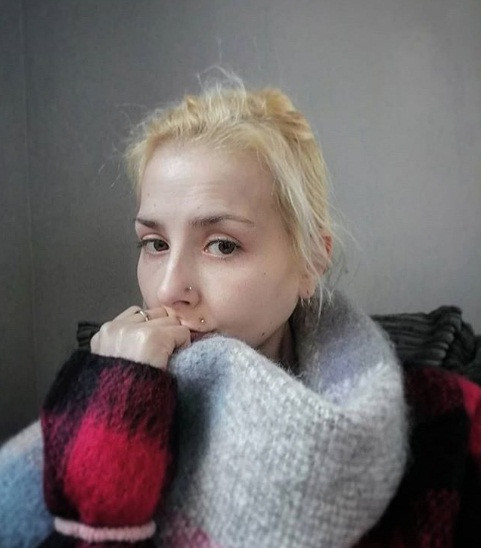 Nhạy cảm với nhiệt độ thấp: Khi giảm cân, bạn sẽ mất chất béo phủ trên cơ thể. Không có lớp mỡ này, cơ thể bạn trở nên nhạy cảm hơn với những thay đổi về nhiệt độ, đặc biệt là trong thời tiết lạnh.