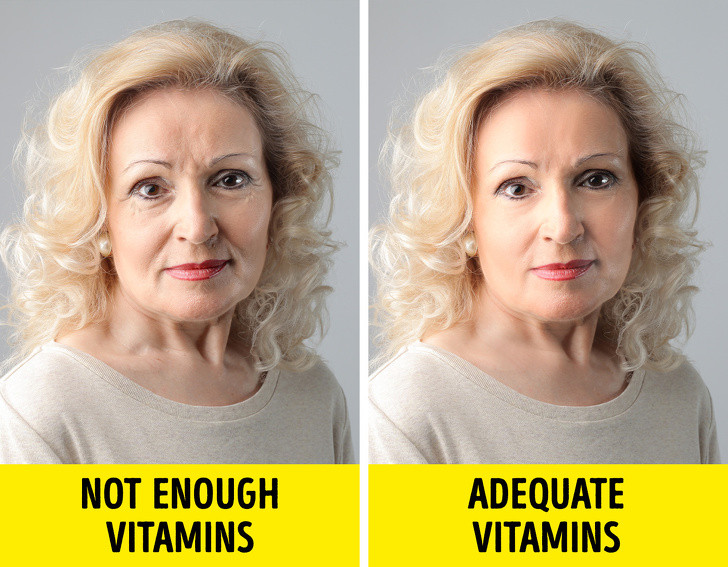 3. Da đẹp hơn: Vitamin C, E và K có trong đậu gà rất quan trọng đối với sức khỏe của da. Chúng giúp chữa lành vết thương, loại bỏ nếp nhăn, ngăn ngừa khô da và bảo vệ chống lại tác hại của ánh nắng mặt trời.