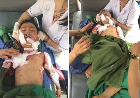 Trước đó có không ít vụ trẻ em bị chó nhà tấn công gây ra hậu quả thương tâm. Hồi tháng 4, một bé trai 7 tuổi tại xã Khôi Kỳ, huyện Đại Từ, Thái Nguyên bị chó cắn tử vong trong lúc đang chơi đùa, do vết thương quá nặng dù được cấp cứu nhưng cháu không qua khỏi. Con chó tấn công cháu bé do gia đình mới bắt từ nhà bà nội về nuôi.