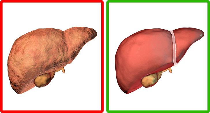 Thải độc gan: Uống sữa nghệ giúp tẩy rửa những axit béo còn dư thừa trong gan, thải bỏ những chất độc còn đọng lại, giúp tăng cường sức khoẻ cho hệ tiêu hoá.