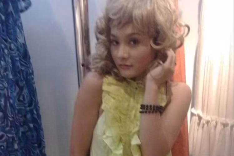 Nhan sac that cua Bao Thanh truoc khi phau thuat tham my