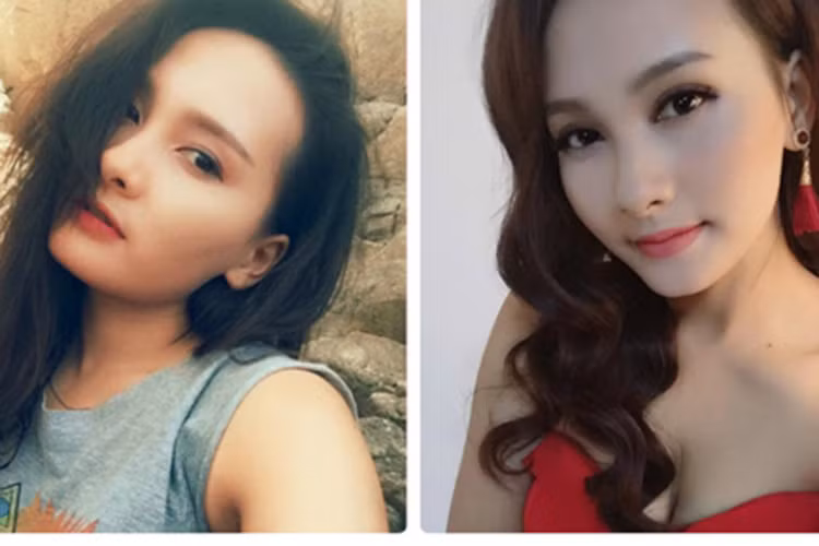 Bảo Thanh chia sẻ, sở dĩ cô lựa chọn việc phẫu thuật cắt mí là vì: nữ diễn viên thường xuyên phải trang điểm, thức khuya để đóng phim, nên mắt cô không còn đẹp như trước nữa, mi mắt bị sụp, da thừa xuất hiện nhiều...