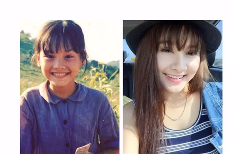 Vốn dĩ diễn viên Bảo Thanh đã xinh đẹp từ bé. Phẫu thuật đã giúp cho đôi mắt của cô rạng rỡ hơn.