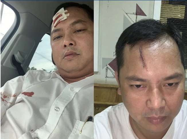 Ông Lê Võ Trường Hải (45 tuổi, ngụ Đắk Lắk), người bị nhóm đi cùng trung tá công an đập ghế vào đầu phải khâu 13 mũi ở trán cho biết, trưa 12/6, ông được ông Nguyễn Tấn Lương (37 tuổi, ngụ TP.Biên Hòa) mời đến quán Lam Viên ăn cơm. Theo lời ông Hải, khi ra tính tiền, ông và ông Lương đứng trước cửa nói chuyện thì một người ở phòng sát bên chạy ra nôn ói trúng người ông Lương. Sau này, tôi mới biết người này tên Phạm Văn Hiền (34 tuổi, ngụ Định Quán, Đồng Nai).