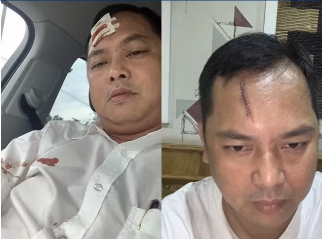 Ông Lê Võ Trường Hải (45 tuổi, ngụ Đắk Lắk), người bị nhóm đi cùng trung tá công an đập ghế vào đầu phải khâu 13 mũi ở trán cho biết, trưa 12/6, ông được ông Nguyễn Tấn Lương (37 tuổi, ngụ TP.Biên Hòa) mời đến quán Lam Viên ăn cơm. Theo lời ông Hải, khi ra tính tiền, ông và ông Lương đứng trước cửa nói chuyện thì một người ở phòng sát bên chạy ra nôn ói trúng người ông Lương. Sau này, tôi mới biết người này tên Phạm Văn Hiền (34 tuổi, ngụ Định Quán, Đồng Nai).