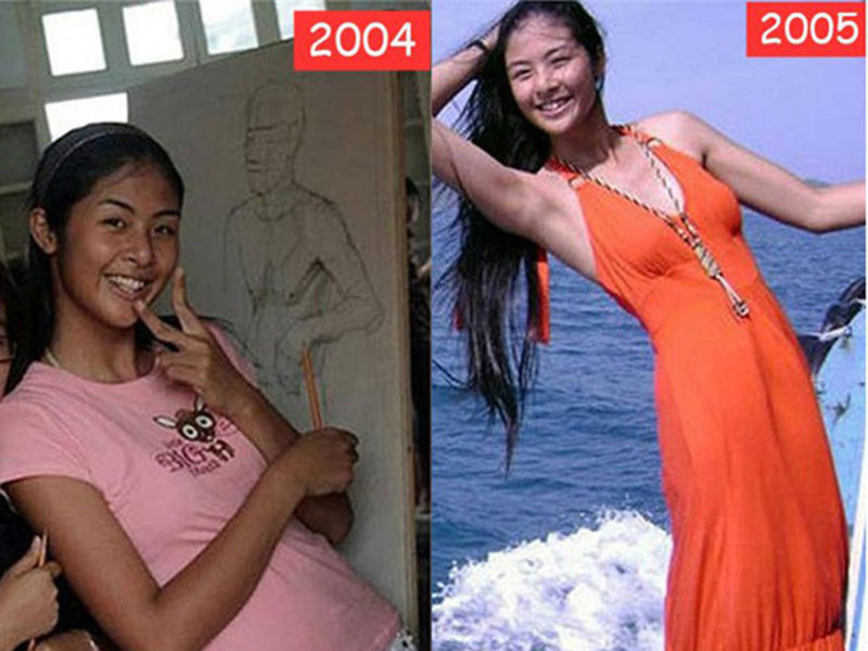 Ở tuổi 15, Ngọc Hân có làn da ngăm đen, hàm răng không đều, đôi mắt nhỏ, số đo 3 vòng chưa chuẩn. Ảnh: Zing