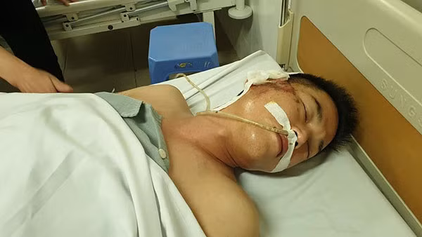 Lo danh tinh lai xe Mazda CX5 ban thung bung tai xe Taxi-Hinh-2