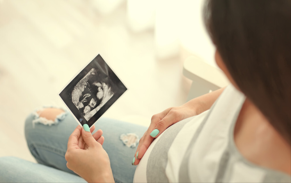 Nước ối đục độ 2 : Nước ối có màu xanh đậm hoặc xanh vàng, có phân su nổi và nhiều chất béo màu trắng xung quanh thai nhi. Thai nhi sẽ rơi vào giai đoạn thiếu oxy cấp tính, có thể ảnh hưởng đến sự phát triển bình thường của não bộ và các cơ quan khác của cơ thể, tình hình nguy kịch hơn.