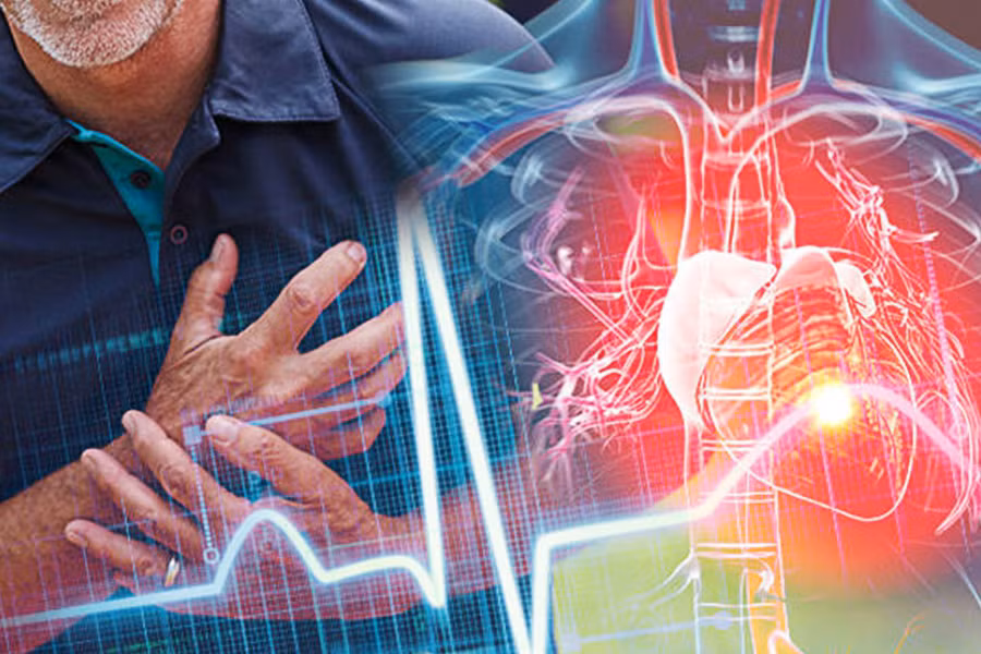 Khoảng 75% -95% bệnh nhân nhồi máu cơ tim sẽ bị rối loạn nhịp tim 1-2 tuần trước khi khởi phát. Đồng thời có thể bị mệt mỏi, chóng mặt, thậm chí ngất xỉu. Cũng có 32% -48% bệnh nhân sẽ bị suy tim, nói chung là suy tim trái. Người bệnh cần chú ý đến tín hiệu do cơ thể gửi đến, đi khám ngay khi có thể để đảm bảo sức khỏe và an toàn của bản thân.