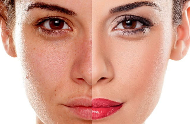 Hiện tượng sạm da mặt cũng chứng tỏ thận khí không đủ, thận dương thiếu hụt, bên cạnh đó, hiện tượng tóc bạc bất ngờ cũng là dấu hiệu tận bị tổn thương, cần lưu ý để phát hiện bệnh sớm.