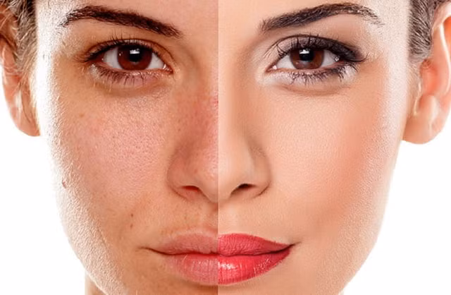 Hiện tượng sạm da mặt cũng chứng tỏ thận khí không đủ, thận dương thiếu hụt, bên cạnh đó, hiện tượng tóc bạc bất ngờ cũng là dấu hiệu tận bị tổn thương, cần lưu ý để phát hiện bệnh sớm.