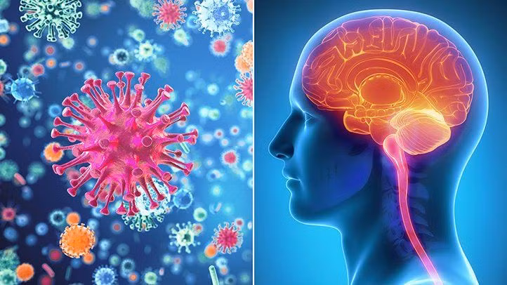 Nếu nằm trong nhóm có tỷ lệ mắc viêm màng não do vi khuẩn Listeria meningitis cao hơn, bạn phải cẩn thận hơn, đừng bao giờ chủ quan để rồi hối không kịp.