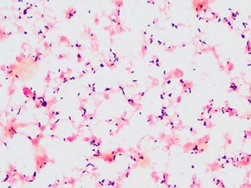 Vi khuẩn này đi qua niêm mạc đường tiêu hóa sau đó qua 2/3 hạch bạch huyết rồi hòa vào máu, tiếp tục di chuyển đến lá lách, gan và hệ thần kinh trung ương cuối cùng gây ra bệnh viêm màng não.