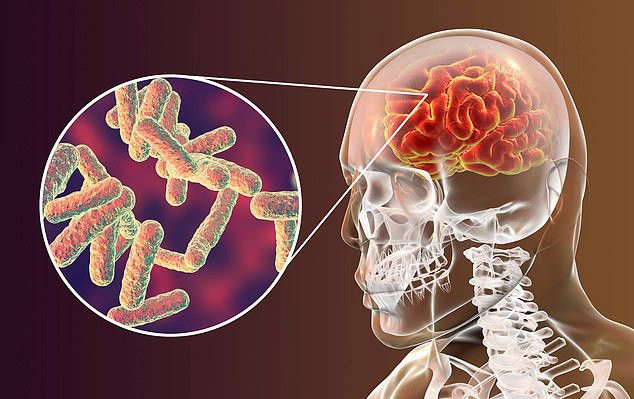 Trong trường hợp của cô Lữ, may mắn là cô đã đến bệnh viện kịp thời, nếu không hậu quả sẽ khó có thể tưởng tượng được.