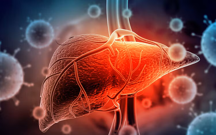 2. Mệt mỏi, chán ăn, chướng bụng, sút cân: Khi khối u phát triển lớn, bệnh nhân ung thư gan có thể xuất hiện các triệu chứng như mệt mỏi, chán ăn, chướng bụng, sút cân...