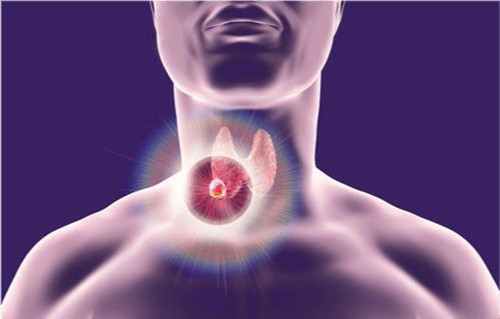 Vut ngay hai thu nay khoi bep neu khong muon ung thu tuyen giap