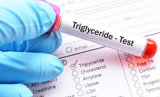 Bệnh mỡ máu hiện nay rất phổ biến vì nó có liên quan mật thiết đến chế độ ăn uống của chúng ta. Ông Trương, người Trung Quốc, năm nay 68 tuổi, gần đây luôn cảm thấy tức ngực và chóng mặt, rất khó chịu, gia đình quyết định sẽ đưa ông đi khám tổng thể.