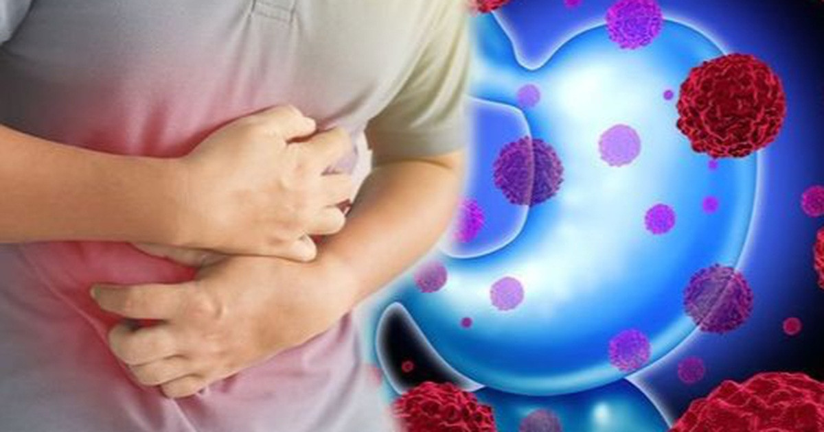 Ngoài ô nhiễm không khí, di truyền và các yếu tố khác, còn có một yếu tố gây ung thư không thể bỏ qua, đó là thói quen sinh hoạt và ăn uống không lành mạnh. Đặc biệt nếu thói quen ăn uống không tốt, dễ khiến tế bào ung thư xuất hiện và phát triển nhanh.