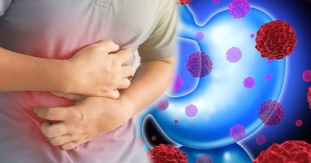 Ngoài ô nhiễm không khí, di truyền và các yếu tố khác, còn có một yếu tố gây ung thư không thể bỏ qua, đó là thói quen sinh hoạt và ăn uống không lành mạnh. Đặc biệt nếu thói quen ăn uống không tốt, dễ khiến tế bào ung thư xuất hiện và phát triển nhanh.