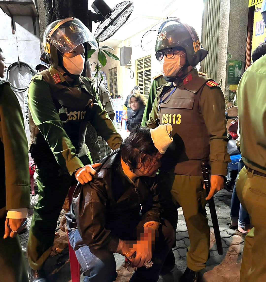 Đã bắt được nghi phạm dùng dao đâm nhiều người bị thương ở Đà Nẵng Da bat duoc nghi pham dung dao dam nhieu nguoi bi thuong o Da Nang