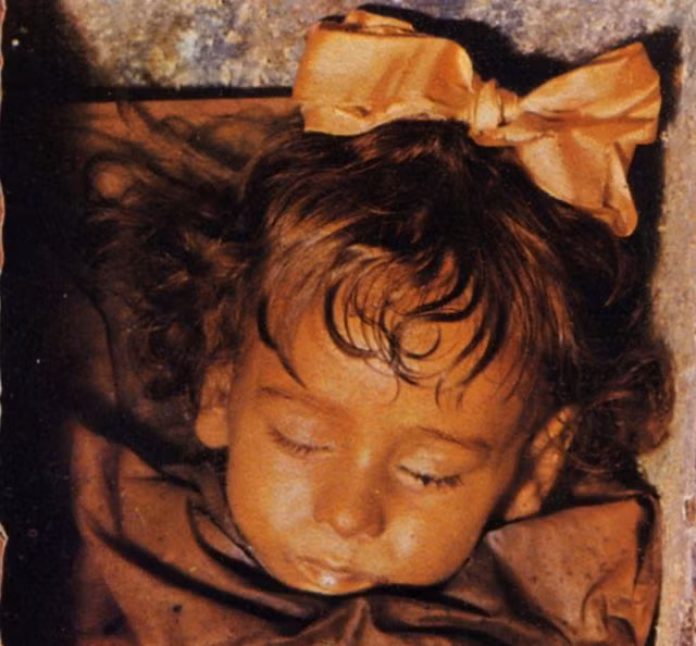 Cha mẹ cô bé đã quyết định ướp xác con để muốn lưu giữ nguyên hình dạng của người con bé bỏng. Xác ướp Lombardo được bảo quản trong hầm mộ Capuchin ở Palermo (Italy) và còn vẹn nguyên đến ngày nay.